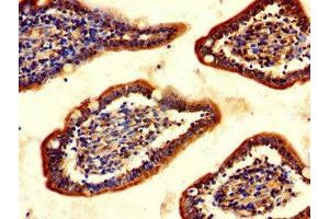 Immunohistochemistry of paraffin-embedded human small intestine tissue using ABIN7147620 at dilution of 1:100 (Choline Acetyltransferase Antikörper  (AA 354-592))