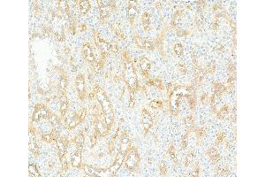 Immunohistochemistry (IHC) image for anti-CD36 (CD36) (AA 30-439) antibody (ABIN7449417)