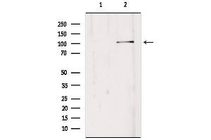 Western blot analysis of extracts from Hepg2, using EDEM3 Antibody. (EDEM3 Antikörper  (C-Term))