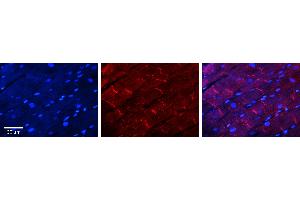 Rabbit Anti-DDIT3 Antibody   Formalin Fixed Paraffin Embedded Tissue: Human Heart Tissue Observed Staining: Cytoplasm in intercalated disc Primary Antibody Concentration: 1:100 Other Working Concentrations: N/A Secondary Antibody: Donkey anti-Rabbit-Cy3 Secondary Antibody Concentration: 1:200 Magnification: 20X Exposure Time: 0.