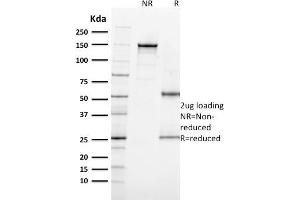 SDS-PAGE Analysis Purified MITF Mouse Monoclonal Antibody (MITF/915). (MITF Antikörper)