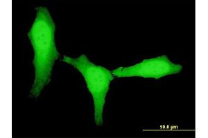 Immunofluorescence of monoclonal antibody to ZEB1 on HeLa cell. (ZEB1 Antikörper  (AA 801-900))