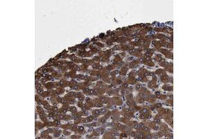 Immunohistochemical staining of human liver with PYGL polyclonal antibody  shows strong cytoplasmic positivity in hepatocytes at 1:500-1:1000 dilution. (PYGL Antikörper)