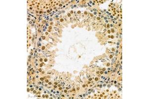 Immunohistochemistry analysis of paraffin embedded rat testis using MASTL (ABIN7074616) at dilution of 1: 2100 (MASTL Antikörper)
