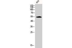 Western Blot analysis of 453 cells using Phospho-CaMKIIα/β/δ (T305) Polyclonal Antibody (CAMK2A/CAMK2B/CAMK2D (pThr305) Antikörper)
