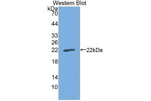 Western Blotting (WB) image for anti-Cell Division Cycle 25 (CDC25) (AA 376-524) antibody (ABIN1867137)