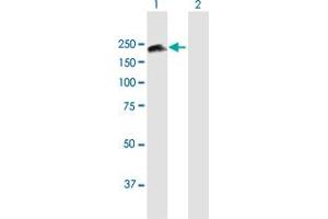 Western Blot analysis of SMC4 expression in transfected 293T cell line by SMC4 MaxPab polyclonal antibody. (SMC4 Antikörper  (AA 1-1288))