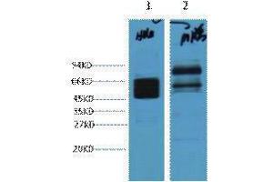 Western Blotting (WB) image for anti-Keratin 8 (KRT8) antibody (ABIN3178608) (KRT8 Antikörper)