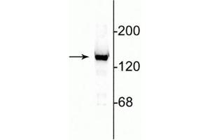 Western blot of 10 µg of rat cerebellar lysate showing specific immunolabeling of the ~140 kDa NR2C subunit of the NMDA receptor.