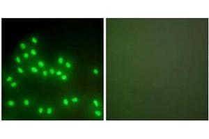 Immunofluorescence analysis of A549 cells, using Ku70/80 Antibody . (XRCC5 Antikörper  (C-Term))
