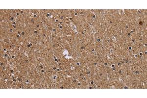 Immunohistochemistry of paraffin-embedded Human brain tissue using CMTM5 Polyclonal Antibody at dilution 1:40 (CMTM5 Antikörper)