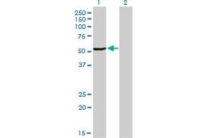 Western Blot analysis of MAK expression in transfected 293T cell line by MAK monoclonal antibody (M02), clone 4E9. (MAK Antikörper  (AA 358-457))