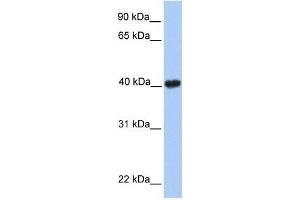 MGC29891 antibody used at 0. (GABPB2 Antikörper  (C-Term))