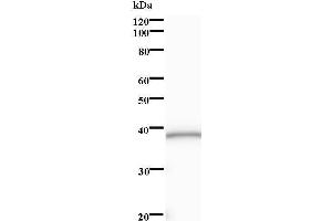 Western Blotting (WB) image for anti-SRY (Sex Determining Region Y)-Box 6 (SOX6) antibody (ABIN931254)