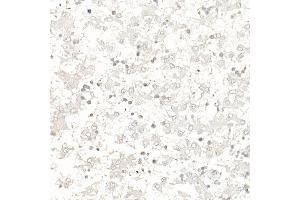 Immunohistochemistry (IHC) image for anti-Baculoviral IAP Repeat-Containing 5 (BIRC5) (AA 1-142) antibody (ABIN6137562)