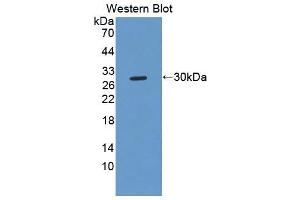 Western Blotting (WB) image for anti-Membrane Protein, Palmitoylated 3 (MAGUK P55 Subfamily Member 3) (MPP3) (AA 385-570) antibody (ABIN5013922)
