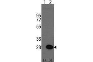 Western blot analysis of HSPB1(arrow) using rabbit polyclonal HSPB1 Antibody (HSP27 Antikörper  (Ser83))