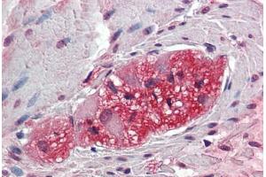 Anti-TXLNB antibody  ABIN960834 IHC staining of human colon, ganglion cells. (Taxilin beta Antikörper  (Internal Region))