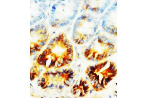 Anti-Alkaline Phosphatase antibody, IHC(P) IHC(P): Rat Small Intestine Tissue (ALPL Antikörper  (N-Term))