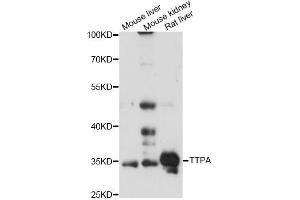 Western blot analysis of extracts of various cell lines, using TTPA antibody (ABIN6293751) at 1:3000 dilution.