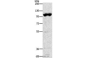 Western blot analysis of Mouse heart tissue, using TRPM5 Polyclonal Antibody at dilution of 1:1200 (TRPM5 Antikörper)