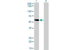 Western Blotting (WB) image for anti-Target of Myb 1 (TOM1) (AA 394-492) antibody (ABIN599110) (TOM1 Antikörper  (AA 394-492))
