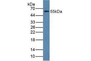 Western blot analysis of Rat Liver Tissue. (FDFT1 Antikörper  (AA 269-417))