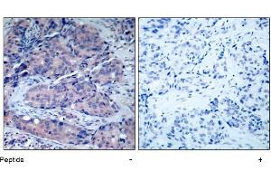 Image no. 1 for anti-Mitogen-Activated Protein Kinase Kinase 4 (MAP2K4) (Thr261) antibody (ABIN197323) (MAP2K4 Antikörper  (Thr261))