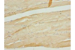 Immunohistochemistry of paraffin-embedded human skeletal muscle tissue using ABIN7173467 at dilution of 1:100 (TRIM55 Antikörper  (AA 101-300))