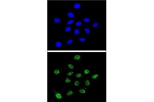 Confocal immunofluorescent analysis of DKC1 Antibody (Center) (ABIN651670 and ABIN2840353) with 293 cell followed by Alexa Fluor® 488-conjugated goat anti-rabbit lgG (green). (DKC1 Antikörper  (AA 185-213))
