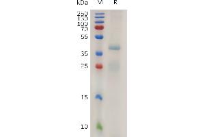 Human R(21-263) Protein, His Tag on SDS-PAGE under reducing condition.
