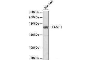 Western blot analysis of extracts of Rat liver using LAMB3 Polyclonal Antibody at dilution of 1:1000. (Laminin beta 3 Antikörper)
