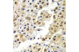 Immunohistochemistry (Paraffin-embedded Sections) (IHC (p)) image for anti-Synaptotagmin Binding, Cytoplasmic RNA Interacting Protein (SYNCRIP) (AA 1-200) antibody (ABIN6148764)