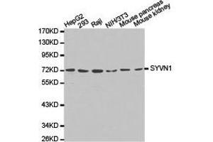 Western Blotting (WB) image for anti-Synovial Apoptosis Inhibitor 1, Synoviolin (SYVN1) antibody (ABIN1875011) (SYVN1 Antikörper)