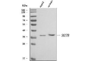 Western blot analysis of SGT2/SGTB using anti-SGT2/SGTB antibody (ABIN7600533).