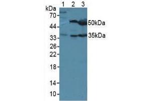 Western blot analysis of (1) Mouse Sp2/0 Cells, (2) Mouse Liver Tissue and (3) Mouse Pancreas Tissue. (LRG1 Antikörper  (AA 136-342))