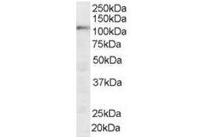 Image no. 1 for anti-Squamous Cell Carcinoma Antigen Recognized By T Cells (SART1) (N-Term) antibody (ABIN374288) (SART1 Antikörper  (N-Term))