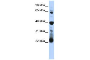 RPUSD3 antibody used at 1 ug/ml to detect target protein. (RPUSD3 Antikörper  (Middle Region))