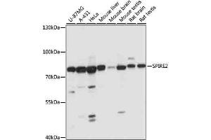 Western blot analysis of extracts of various cells, using SPIRE2 antibody (ABIN7270538) at 1:1000 dilution. (SPIRE2 Antikörper  (AA 1-190))