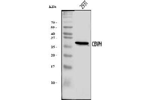 Western blot analysis of CENPH using anti-CENPH antibody (ABIN7601494).