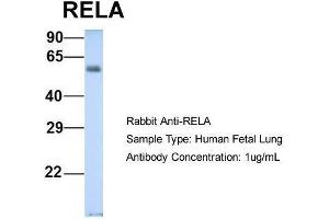 Host: Rabbit  Target Name: RELA  Sample Tissue: Human Fetal Lung  Antibody Dilution: 1.