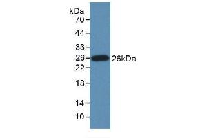 Detection of Recombinant GRIP1, Human using Monoclonal Antibody to Glutamate Receptor Interacting Protein 1 (GRIP1) (GRIP1 Antikörper  (AA 874-1073))