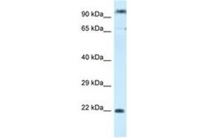 Image no. 1 for anti-Polymerase (RNA) III (DNA Directed) Polypeptide G (32kD)-Like (POLR3GL) (C-Term) antibody (ABIN6747444) (POLR3GL Antikörper  (C-Term))