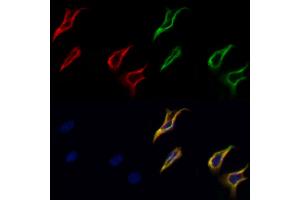 ABIN6264310 and ABIN6277668 staining Hela cells by IF/ICC.
