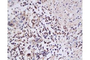 Immunohistochemistry (Paraffin-embedded Sections) (IHC (p)) image for anti-Nuclear Apoptosis Inducing Factor 1 (NAIF1) (AA 3-85) antibody (ABIN668796) (NAIF1 Antikörper  (AA 3-85))