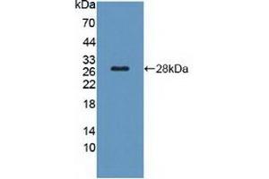 Detection of Recombinant TSHR, Rat using Polyclonal Antibody to Thyroid Stimulating Hormone Receptor (TSHR) (TSH receptor Antikörper  (AA 28-245))
