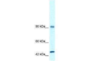 WB Suggested Anti-RBM10 Antibody Titration: 1. (RBM10 Antikörper  (N-Term))
