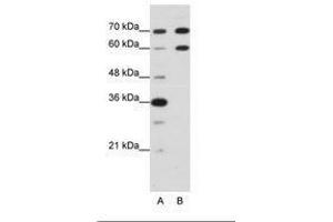 Image no. 2 for anti-Doublesex and Mab-3 Related Transcription Factor 2 (DMRT2) (N-Term) antibody (ABIN203207) (DMRT2 Antikörper  (N-Term))