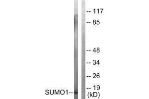 Western blot analysis of extracts from 293 cells, using Sumo1 antibody. (SUMO1 Antikörper  (N-Term))