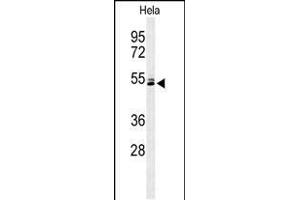 Western blot analysis of K2C78 Antibody (Center) (ABIN653813 and ABIN2843087) in Hela cell line lysates (35 μg/lane). (Keratin 78 Antikörper  (AA 176-203))